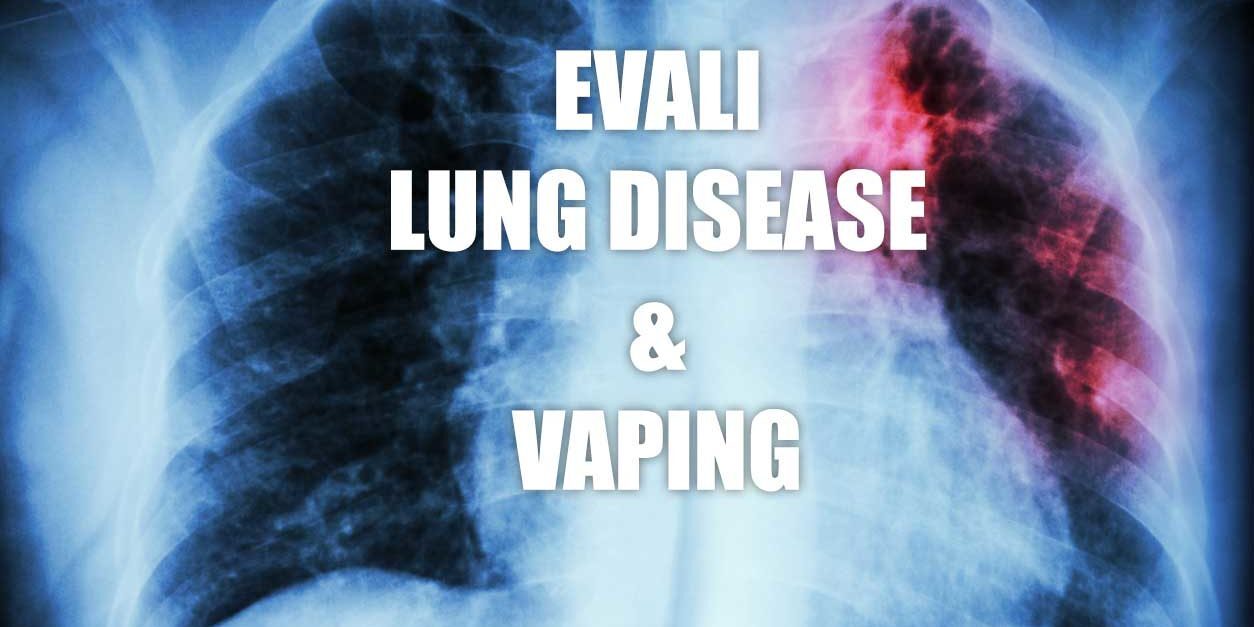 VITAMIN E ACETATE & EVALI LUNG DISEASE Vape Blog