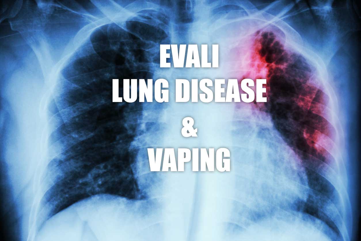 EVALI Lung Disease